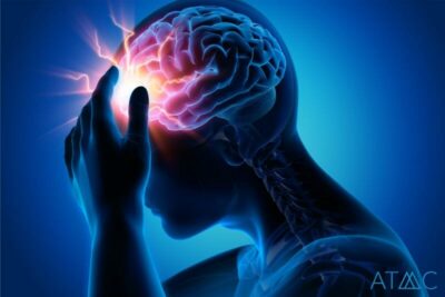 ibuprofen side effects on brain chemistry
